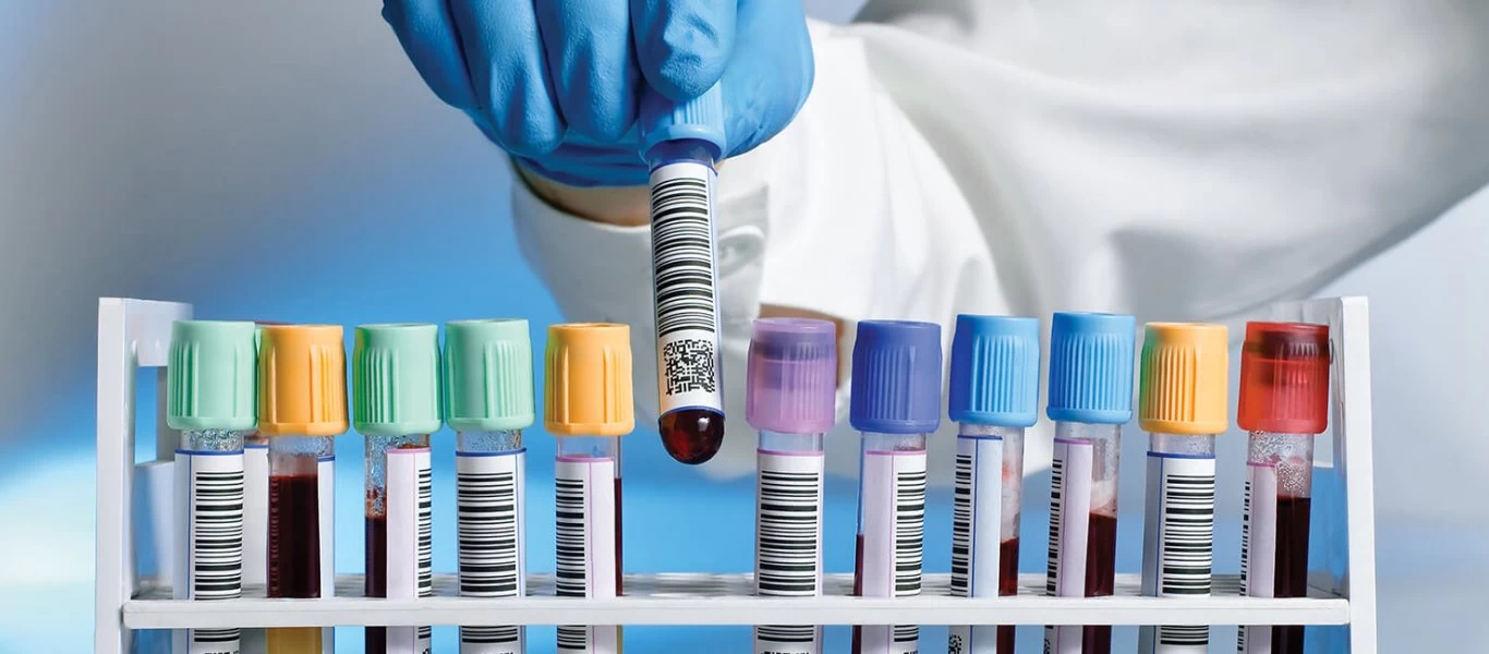 Νέο τεστ προβλέπει με 83% επιτυχία αν θα πεθάνεις στα επόμενα χρόνια!